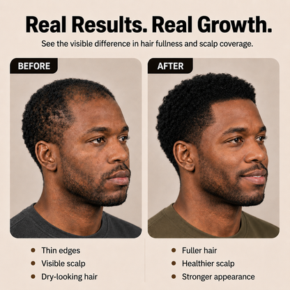 My Melanin Hair Batana Oil for Men