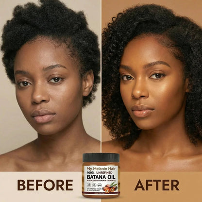MyMelanin™ - Gentle Hair Regrowth Treatment
